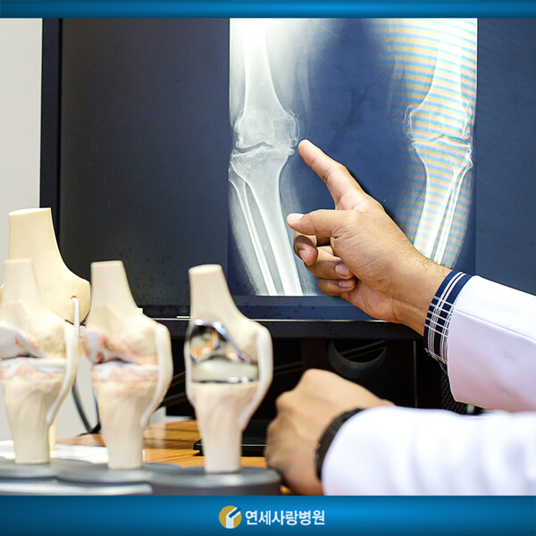 퇴행성 관절염 [사진=연세사랑병원 제공]