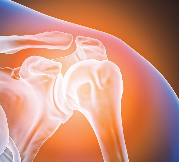 이미지=연세사랑병원 제공